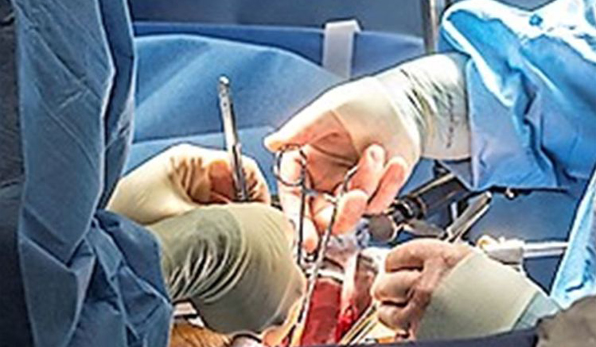 Surgery